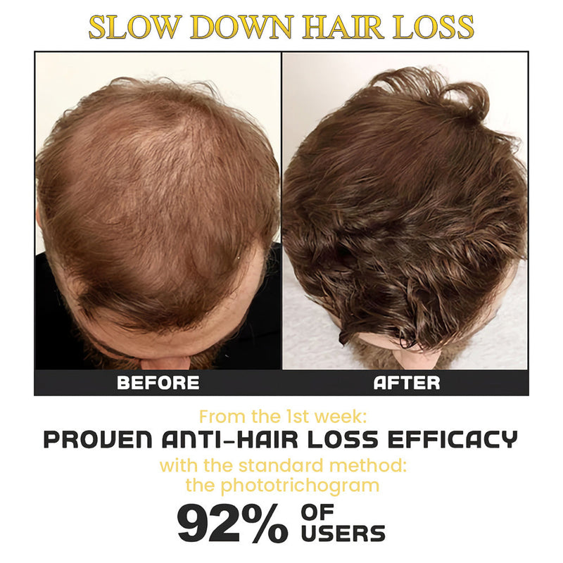 HairGrow™ Haarwuchsroller (1+1 GRATIS!)