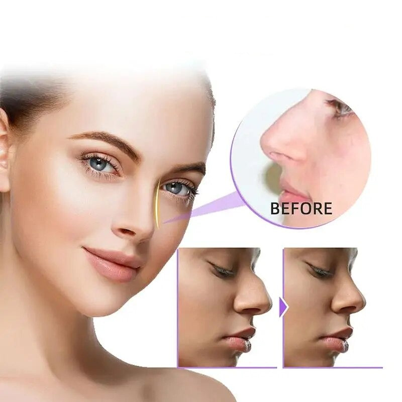 NoseShaper™ Gerät zur Nasenformung