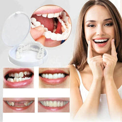 BraceBlend™ Oberes und Unteres Zahnverblendungsset (1 + 1 GRATIS)
